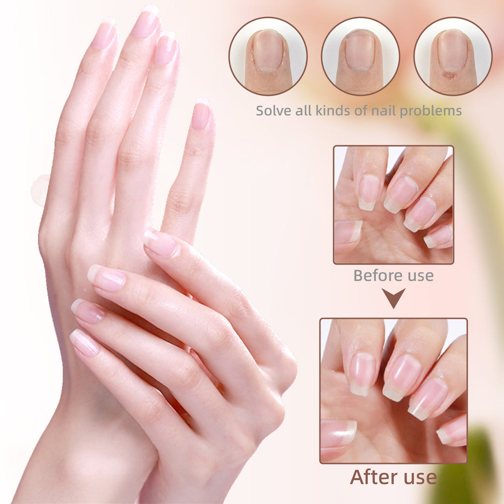 Tencoco moisturizing cuticle oil set for dry cuticles